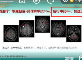 感慨！！！一个非常令人伤感的病例