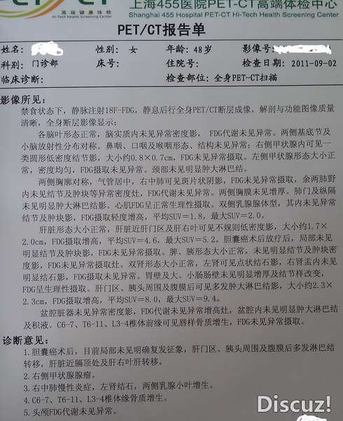 期间复查，CA199一直1000左右，做了增强CT，这边医生不肯定，就去上海做了个PEC-CT。结论出来，肝上有肿瘤