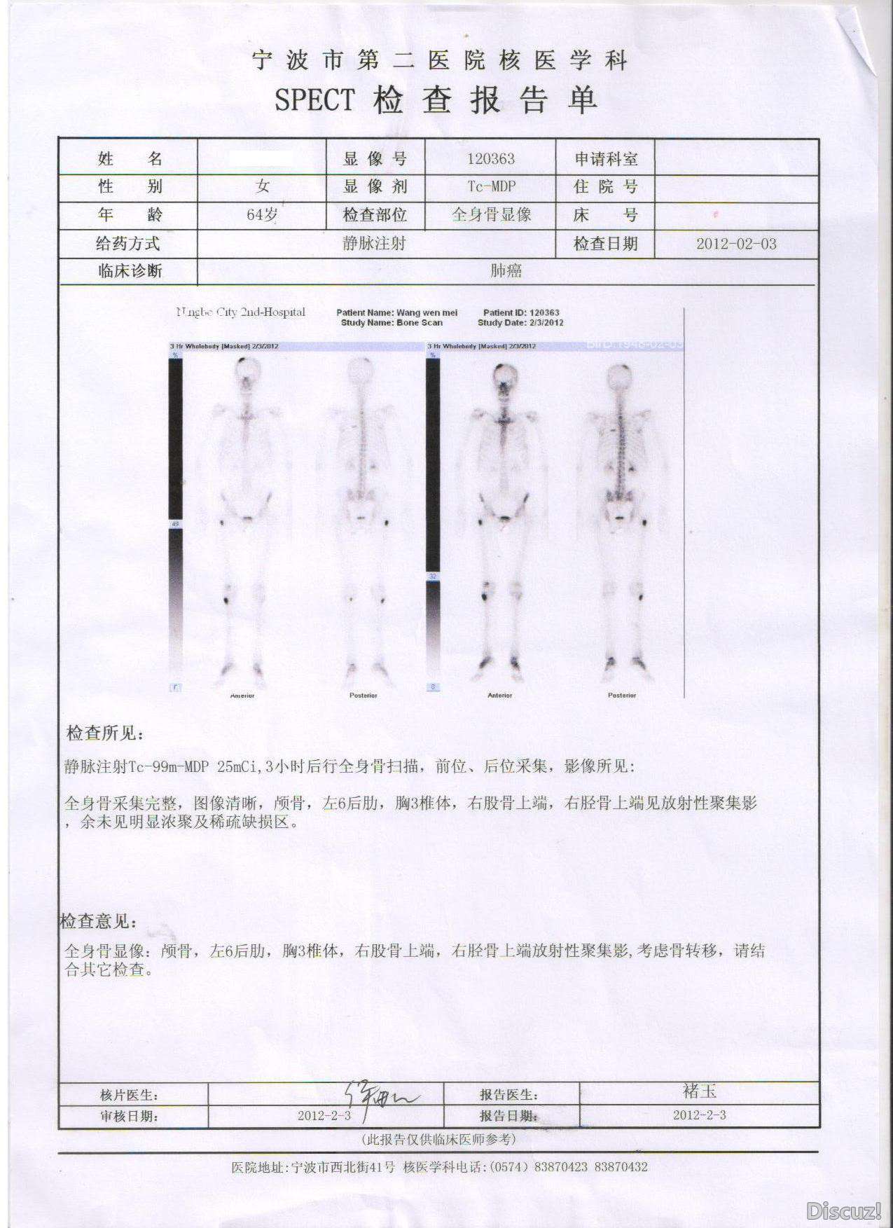 服易瑞沙8个月时的ECT 结果