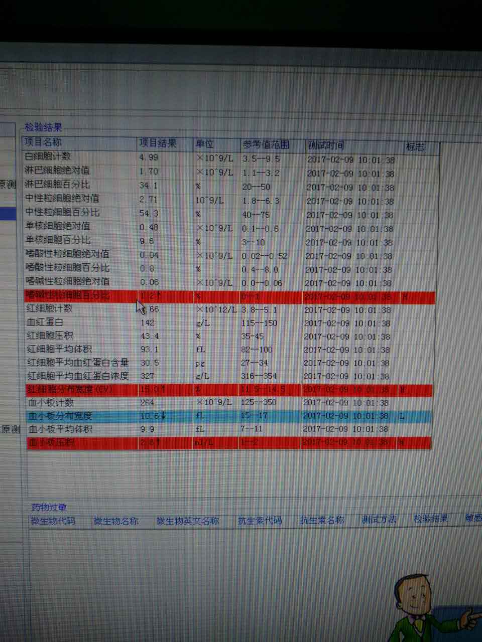115624qssy16on1ugyl1od.JPG