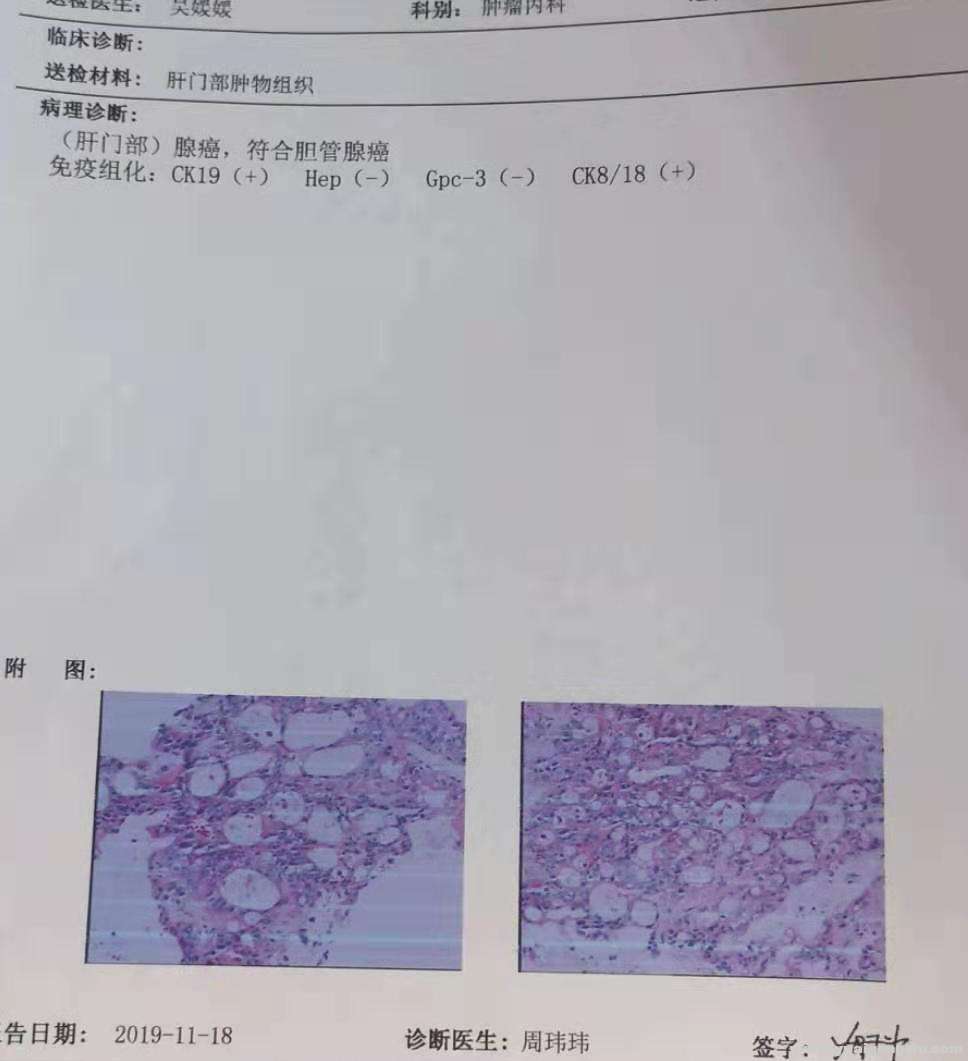 病理报告