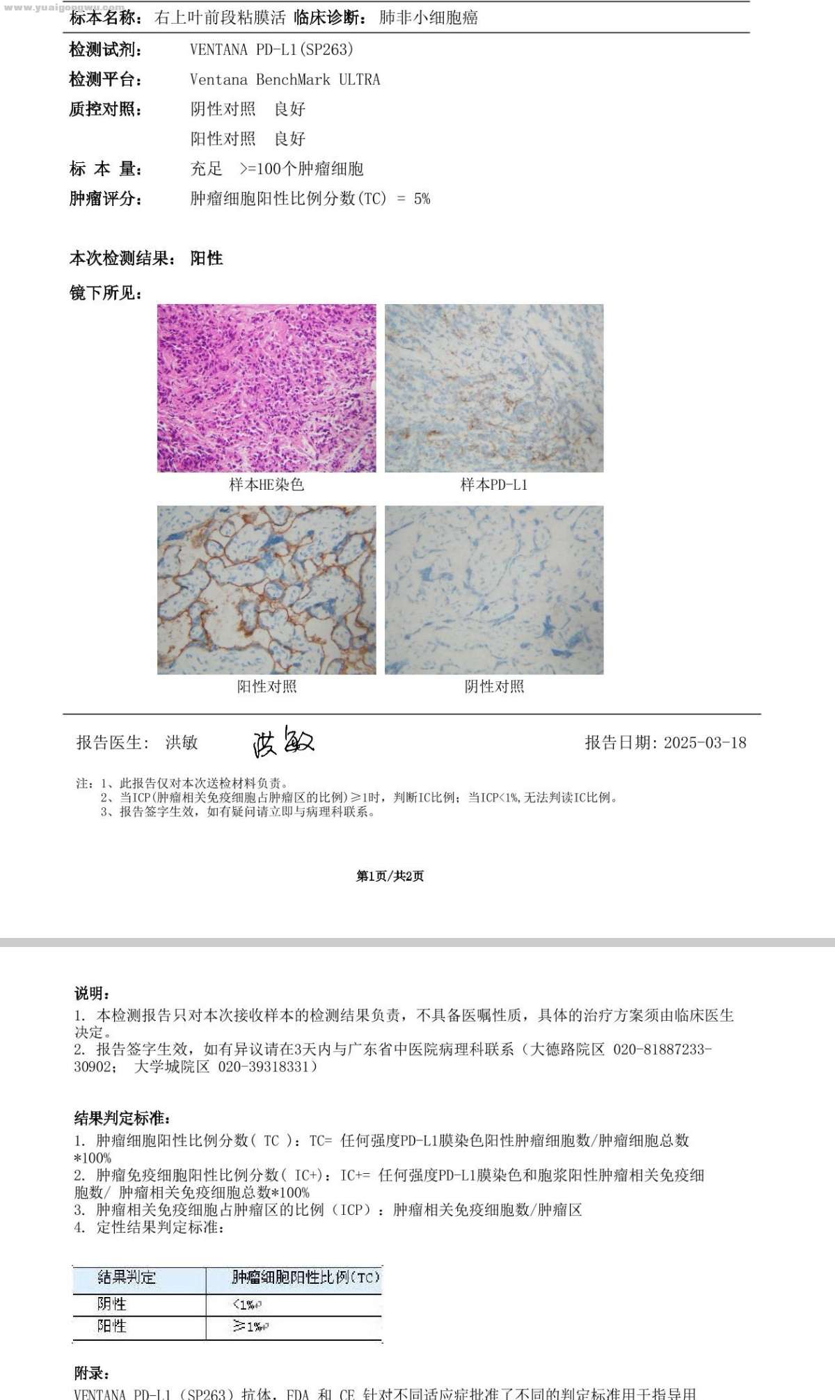 PDL1表达